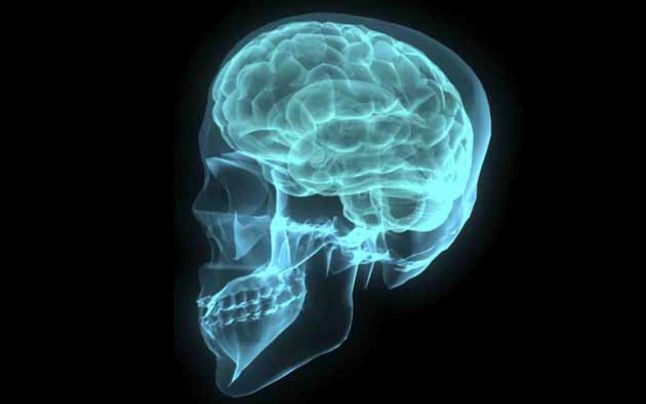 Análisis en línea gratuito de resonancia magnética del cerebro