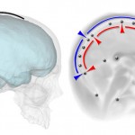 El cerebro moldea la forma del cráneo pero no la extensión de los huesos