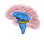Los pacientes con depresión recurrente tienen un hipocampo más pequeño
