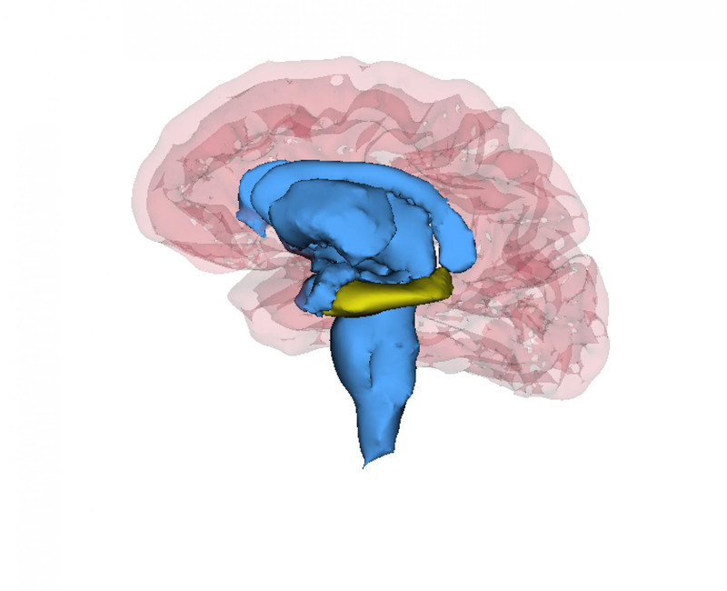 Los pacientes con depresión recurrente tienen un hipocampo más pequeño