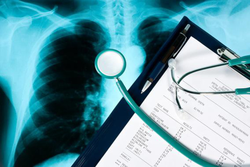 Un desarrollo anormal de los pulmones antes de los 40 predispone a sufrir EPOC