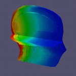 Un nuevo método ayuda a personalizar los tratamientos de radioterapia