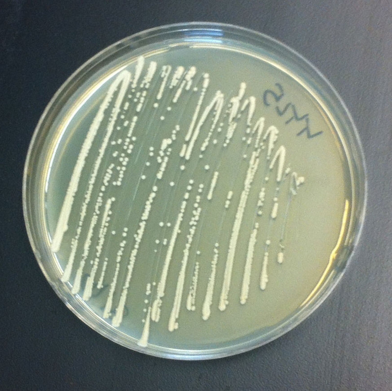 Levadura creciendo en una placa de Petri- Sthephani Galanie
