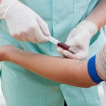 Un análisis de sangre predice la muerte prematura por infección