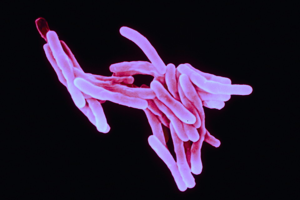 Bacteria Mycobacterium tuberculosis- Sanofi Pasteur