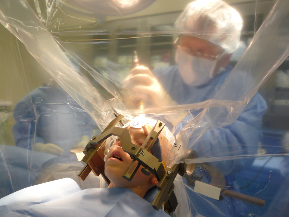 Cirugía pediátrica de un dispositivo de estimulación cerebral profunda- Wikipedia