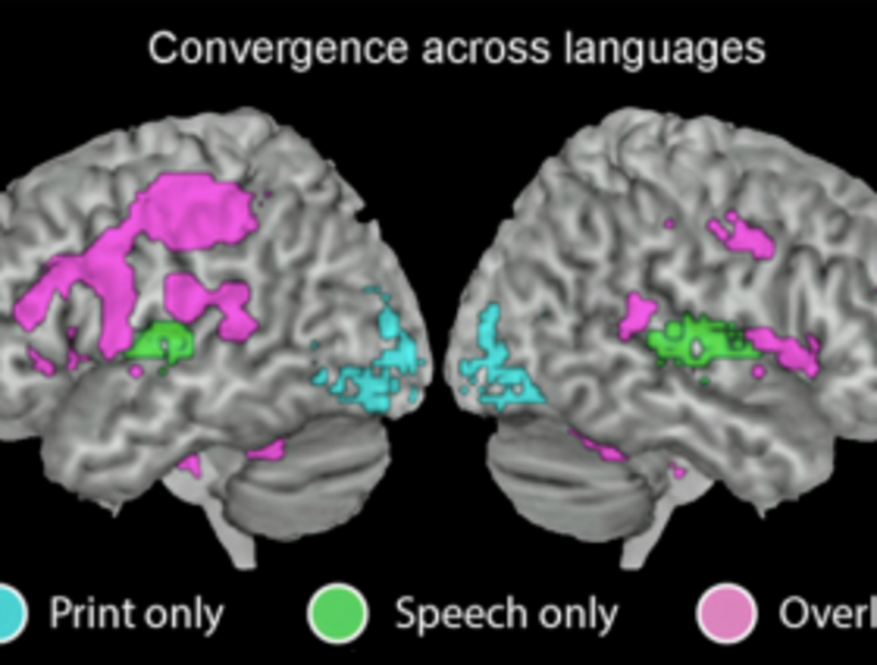 Áreas cerebrales que se activan al descifrar lenguaje escrito (en azul), oral (en verde) o en ambos casos (en morado)- PNAS