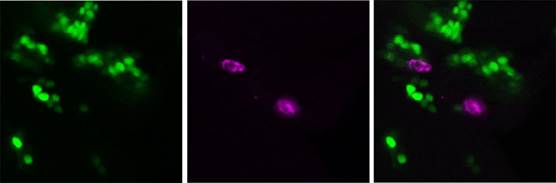 Células epiteliales secretan TyrRS (verdes) que actúa como molécula atractora de macrófagos (magenta)- CSIC