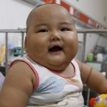 Obesidad infantil, una epidemia que recorre el mundo: 41 millones de niños menores de 5 años