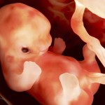 ¿El cáncer puede desarrollarse desde el feto?