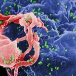 El VIH sigue creciendo incluso si es indetectable en la sangre