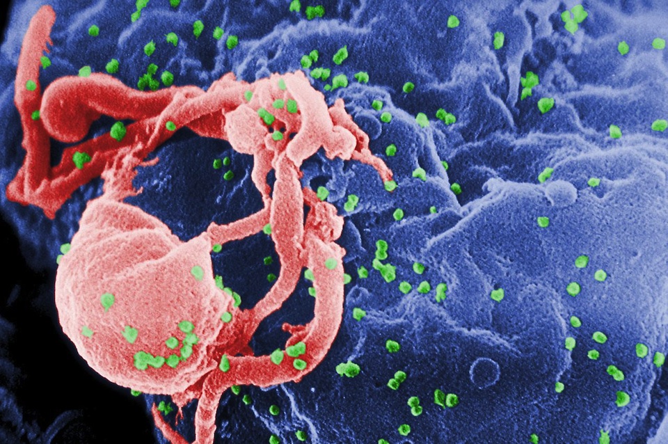 Micrografía electrónica de barrido de VIH-1, CDC/ C Goldsmith