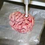 Bisturí inteligente que localiza tumores cancerígenos en el cerebro