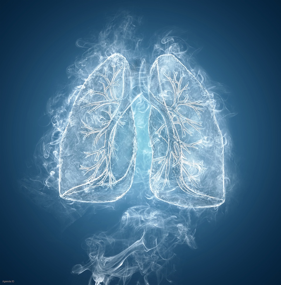 Fibrosis pulmonar idiopática, efectos del humo del cigarro