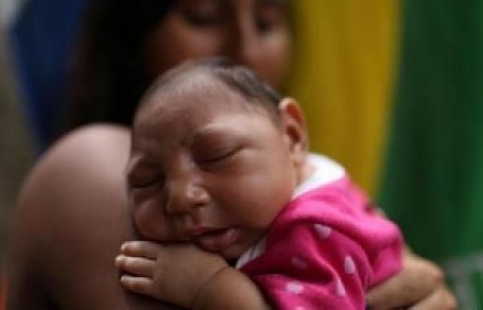 Una madre carga a su hija de un mes con microcefalia provocada por el Zika- Antonio Lacerda, EFE