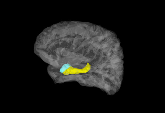 Imagen cerebral en la que aparecen coloreadas la amígdala (azul) y el hipocampo (amarillo). / Stephan Moratti