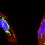 De la nanopartícula al tumor a bordo de una célula madre de placenta
