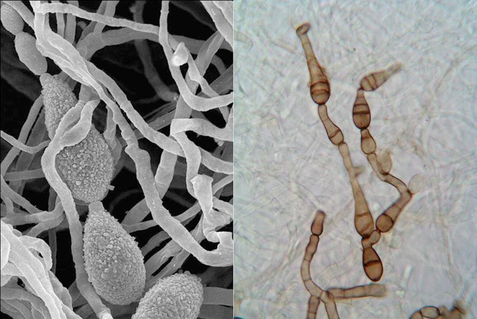 Hongo alternaria alternata visto en un microscopio electrónico (izquierda) y hongo alternaria infectoria visto por un microscopio óptico (derecha). / URV