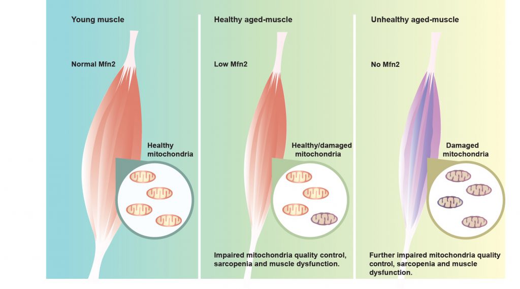 Mitofusina 2 y envejecimiento muscular