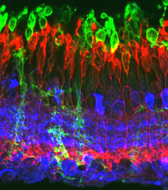 Imagen histológica de la retina de un animal rd10 al mes de edad, en la que se observa una alteración importante de la capa de los fotorreceptores de la retina. / UMH