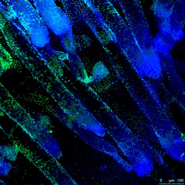 Células madre de la piel. En azul, marcador para el núcleo celular. En verde, marcador para la proteína Dnmt3a, indispensable para que las células conserven las características de célula madre. / Lorenzo Rinaldi, IRB Barcelona