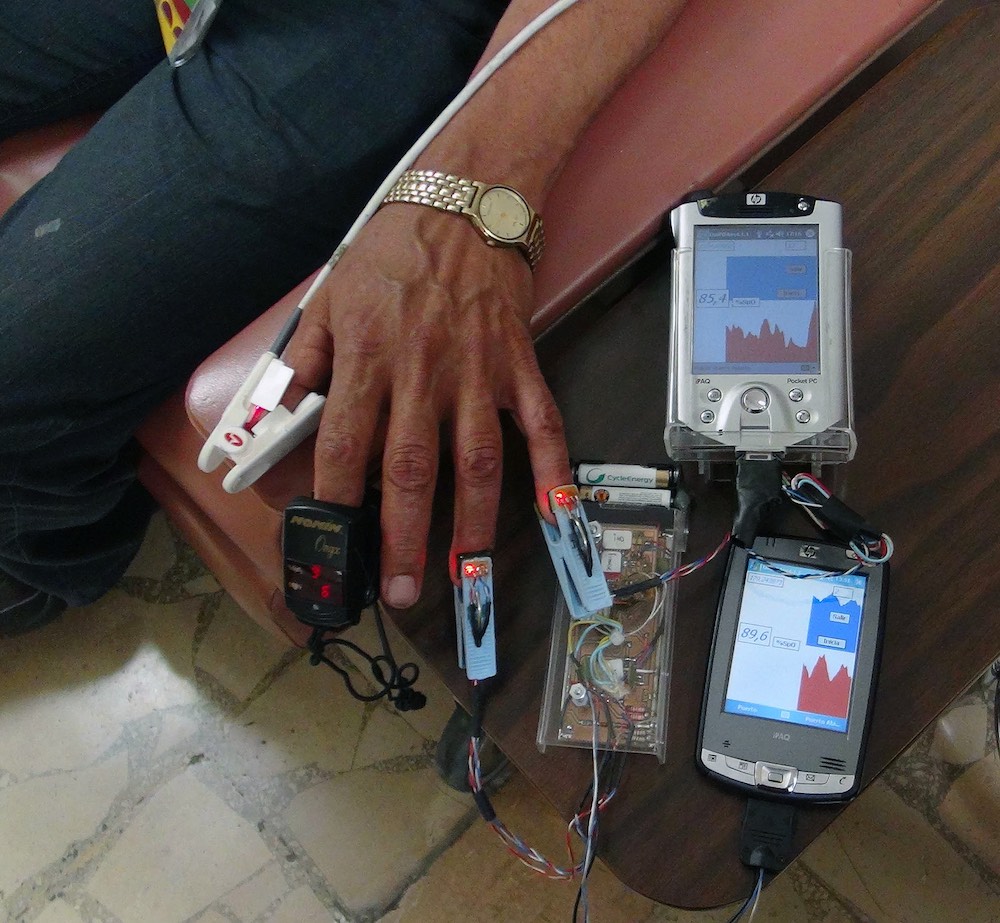 Biodispositivo para monitoreo a distancia de pacientes con diabetes, hipertensión y obesidad