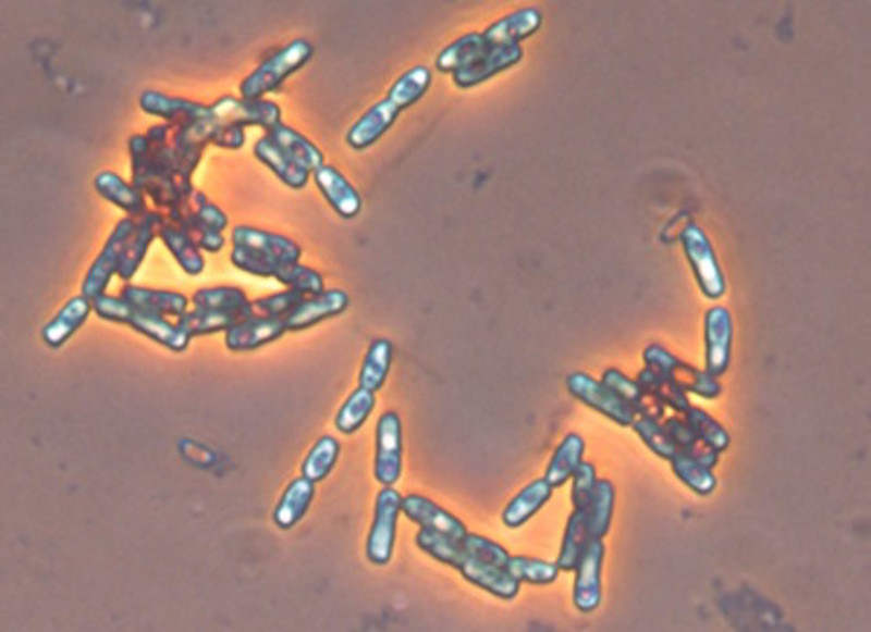 Cepa de Bacillus subtilis