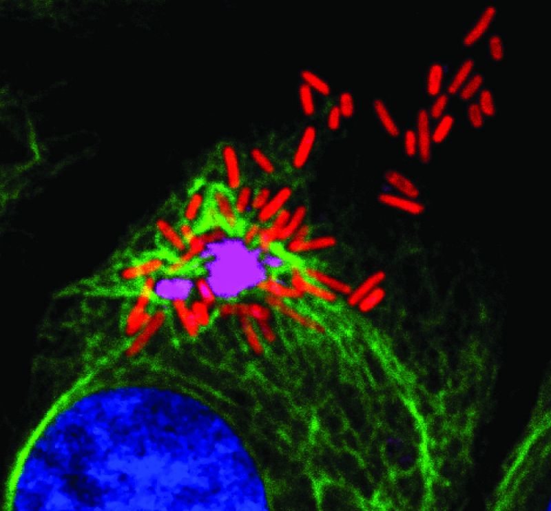 Célula infectada por Salmonella. En rojo bacterias, en morado agregados de membranas, en verde vimentina rodeando el agresoma y en azul núcleo de la célula. / CNB-CSIC