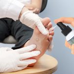 90% de amputaciones de pie diabético se evitan con nanopartículas de plata