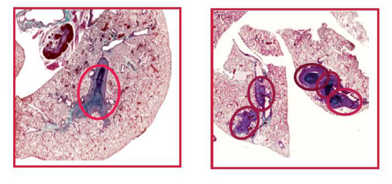 La ausencia de NCoR aumenta la formación de metástasis (rodeadas de círculos rojos). Izquierda: Pulmones de ratones inyectados un mes antes con células de adenocarcinoma que expresan NCoR o en las que se había eliminado este correpresor (derecha). | UAM