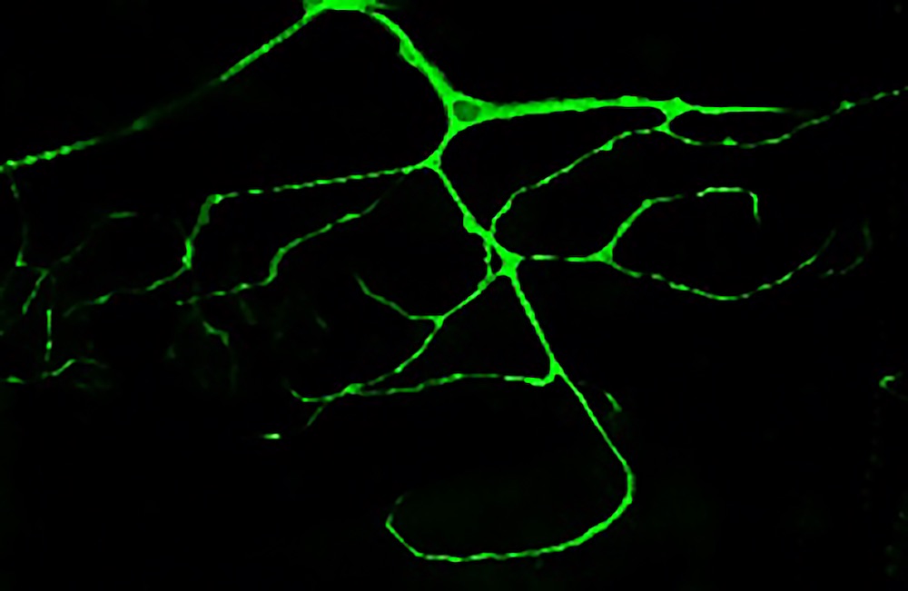 Célula ramificada de la traquea de la larva de Drosophila marcada con GFP- Delia Ricolo, IRB Barcelona