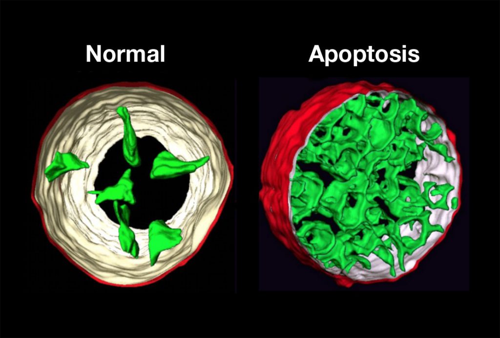 Muerte celular normal y por apoptosis