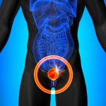 ¿Cuál es la relación del sistema nervioso con el cáncer de próstata?