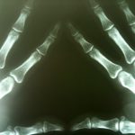El origen de los rayos X