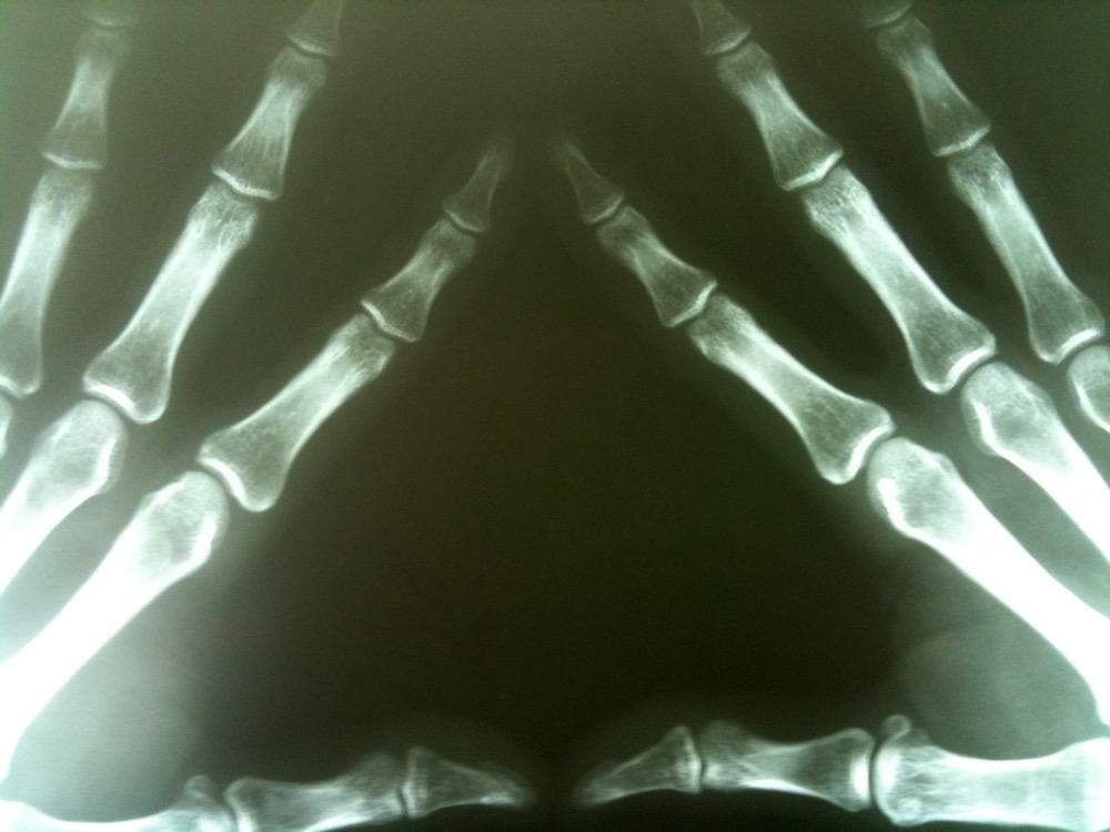 Manos vistas a través de rayos X- Michael Dorausch