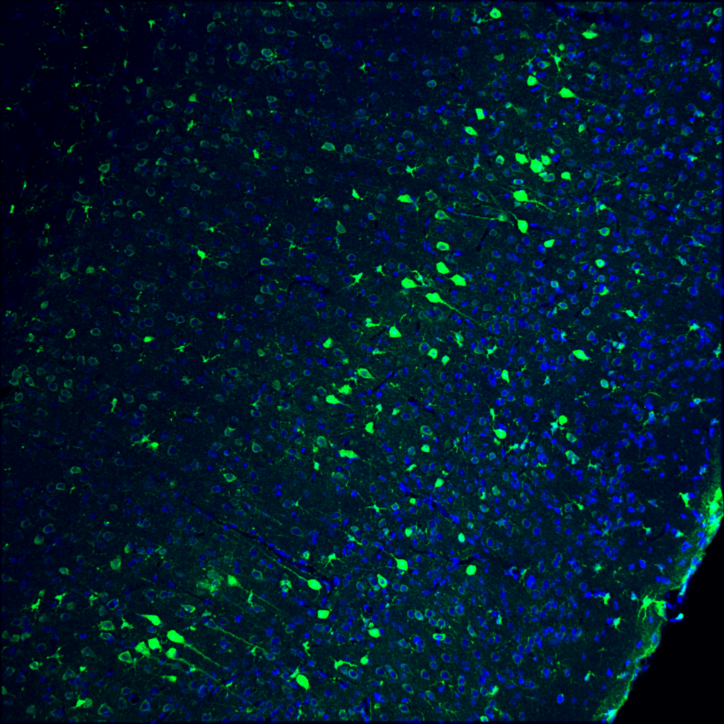 En la imagen, parte del cerebro de un ratón adulto. En azul se muestran los núcleos de las células y, en verde, las neuronas editadas genéticamente. / Salk Institute