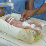 Nuevo tratamiento para cardiopatías congénitas en bebés