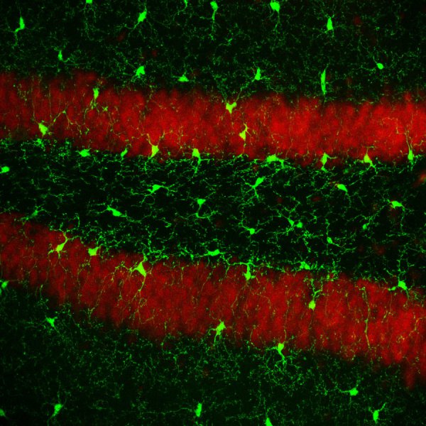 La imagen, utilizada en el estudio, muestra células microgliales (formas verdes) / (c) Dr. Diego Gómez-Nicola (Universidad de Southampton).