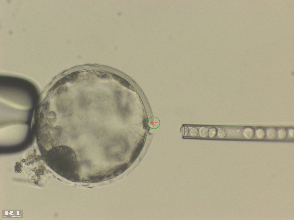 Inyección de células pluripotentes humanas en un blastocito de cerdo- Juan Carlos Izpisua Belmonte