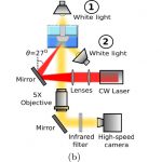 Inyecciones sin aguja, con rayo laser