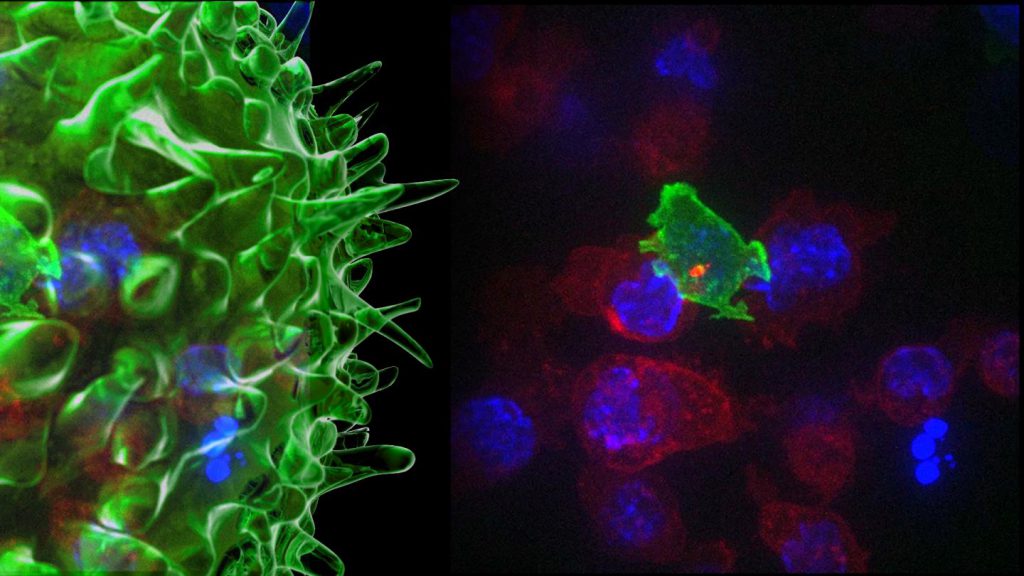Las células verdes son células T citotóxicas que matan células cancerosas azules- Imagen Gillian Griffiths:Jonny Settle