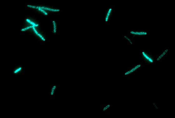 Bacterías E coli, fabricando P450, unidas a la proteína fluorescente verde- DTU