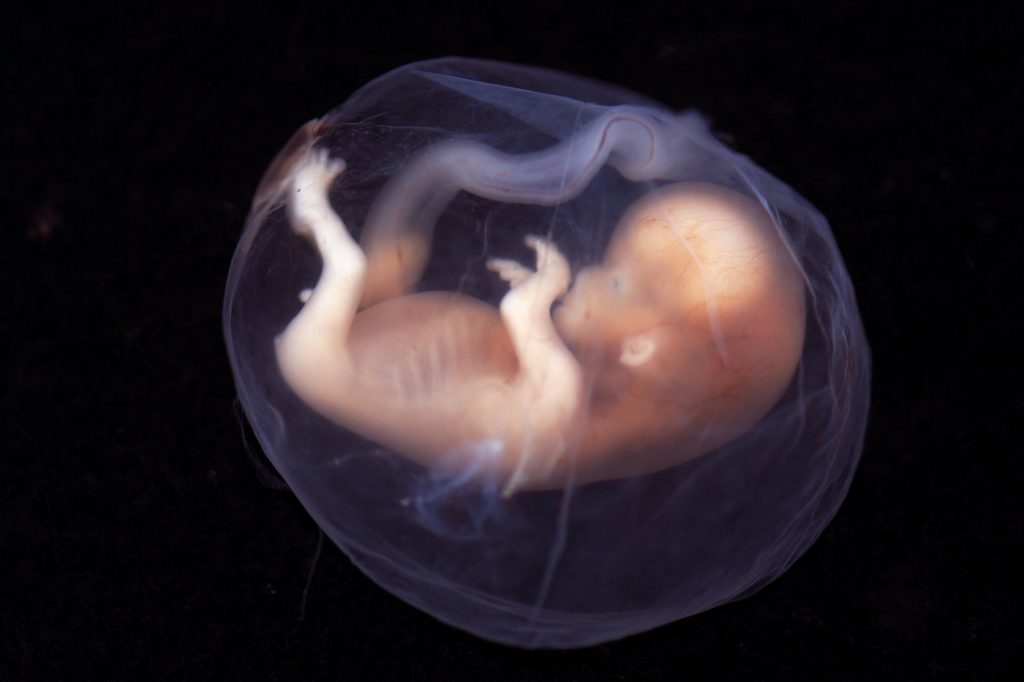 Embrión humano de 9 semanas de gestación- Lunar Caustic