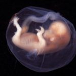 La técnica de los ‘tres padres genéticos’ es eficaz en problemas de infertilidad