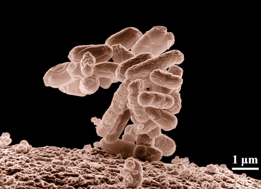 Bacteria E. Coli- Wikipedia