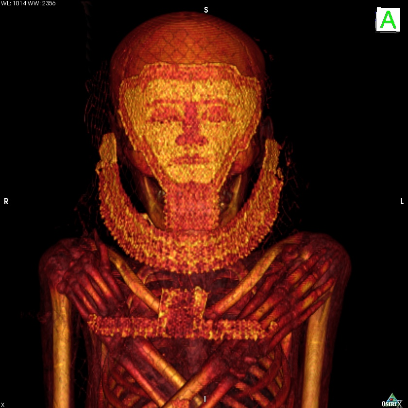 Imagen de una de las momias analizadas con escáner- Universidad de Granada