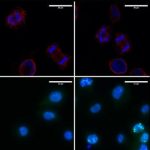 Las células del melanoma no pueden vivir sin la proteína LOXL3