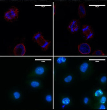 Células de melanoma a las que se le elimina la proteina LOXL3