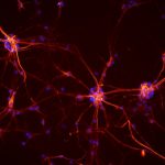 Regeneración de neuronas en neonatos tras una lesión cerebral
