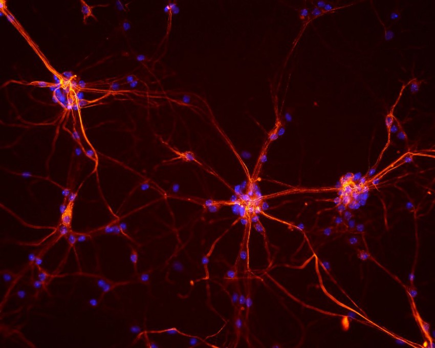 Neuronas de ratón- NICHD